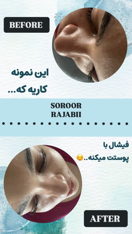 skincare_soroorajabi-20241227-0001