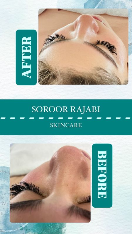 skincare_soroorajabi-20241227-0002