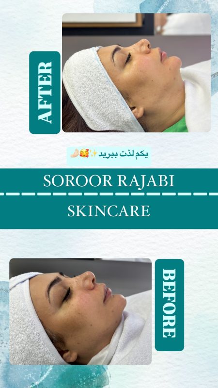 skincare_soroorajabi-20241227-0003