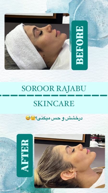 skincare_soroorajabi-20241227-0005