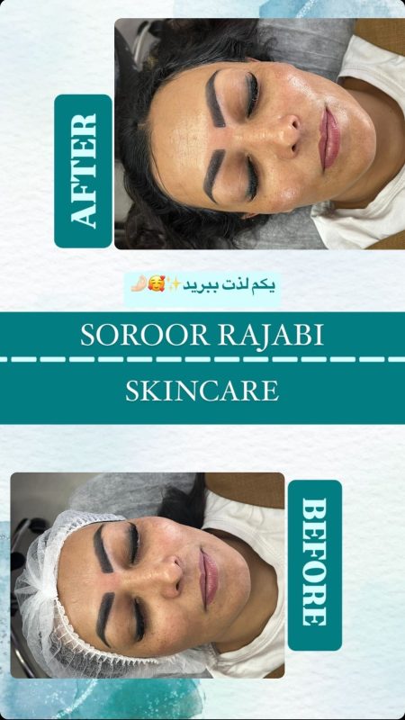 skincare_soroorajabi-20241227-0006